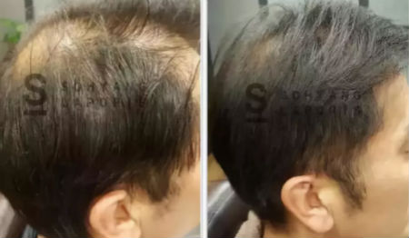 唯拾壹跨境美妝|我缺的不是卷發棒！不是錢！是頭發啊