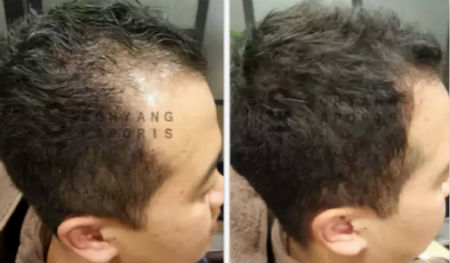 唯拾壹跨境美妝|我缺的不是卷發棒！不是錢！是頭發啊