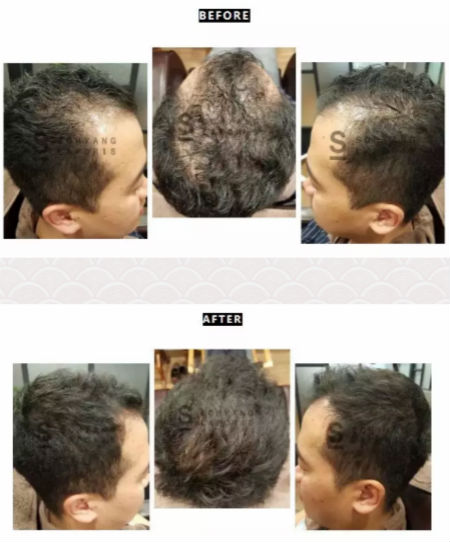 唯拾壹|別人脫單你脫發(fā)？樣的頭皮管理能讓你分分鐘開掛！