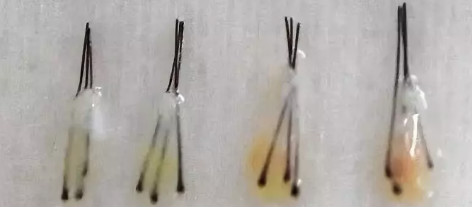 iGLORY完美睫毛增長液，喚醒睫毛逆生長，30天睫毛長一倍