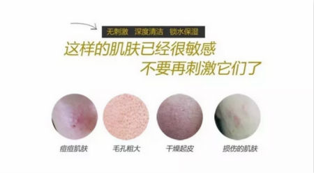 NewNewDIY|敏感肌如何選洗面奶？皮膚科醫(yī)生推薦這款！