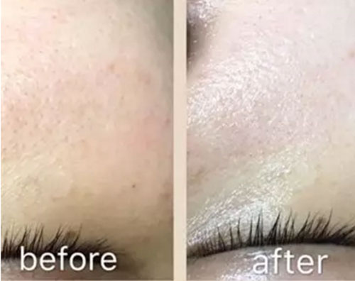 VN紐紐智能光電美膚修復護理