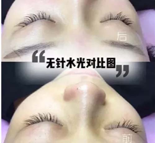 水光嫩膚管理凈化膚色、美白嫩膚