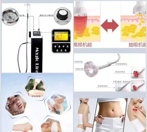 VN身體管理：告別虛胖！不用節食！燃脂塑形躺著就瘦