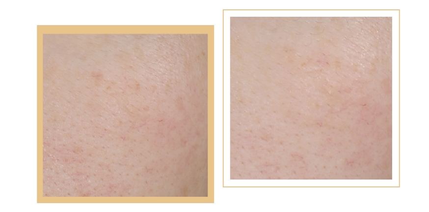 燕麥多糖抗皺乳液 | 抵御衰老侵襲，向時光開戰(zhàn)