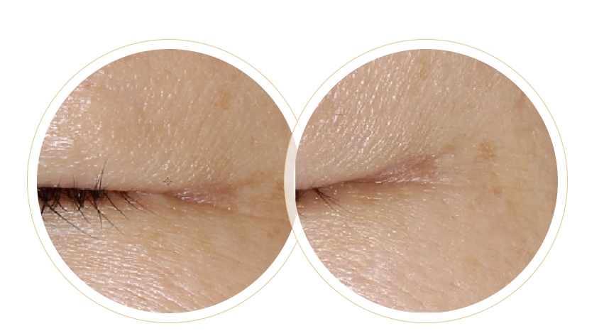 一篇秒懂！為何定期做皮膚管理的人不易老？