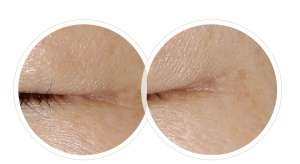 一篇秒懂！為何定期做皮膚管理的人不易老？