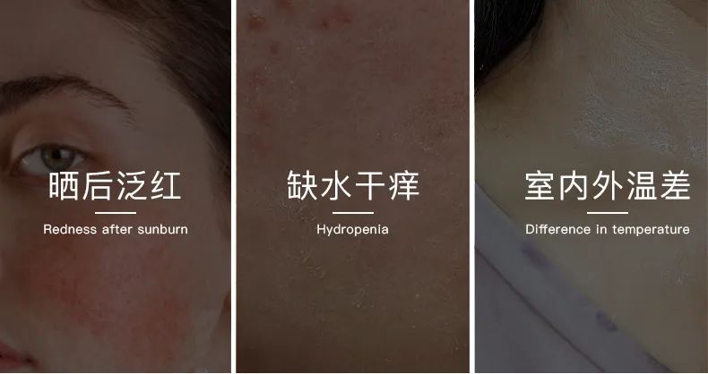 無(wú)懼時(shí)光，天生優(yōu)雅，敏感肌&受損肌的修護(hù)“膜”法